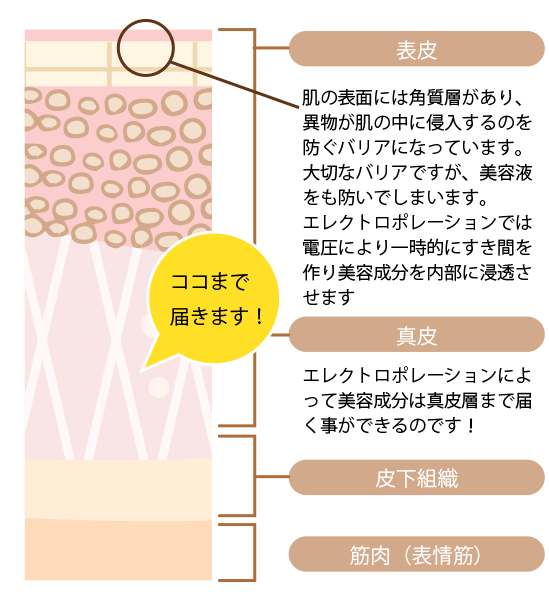 光フェイシャル説明