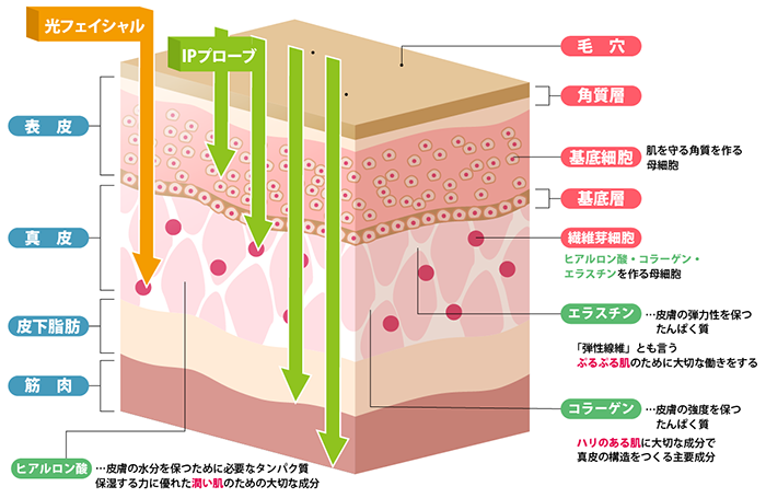 光フェイシャル説明
